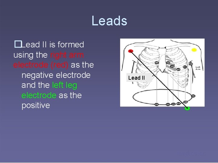 Leads �Lead II is formed using the right arm electrode (red) as the negative