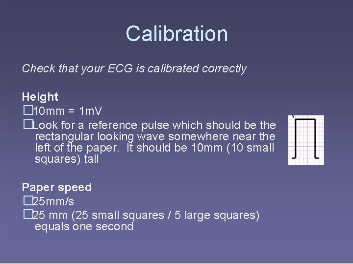 Calibration Check that your ECG is calibrated correctly Height � 10 mm = 1