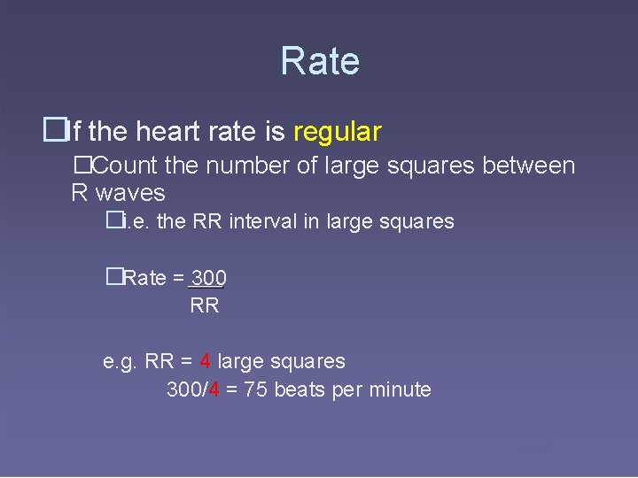 Rate �If the heart rate is regular �Count the number of large squares between