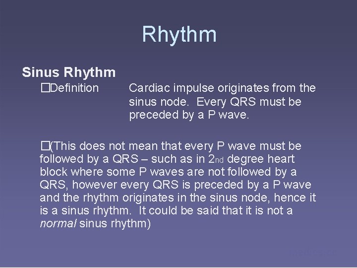 Rhythm Sinus Rhythm �Definition Cardiac impulse originates from the sinus node. Every QRS must