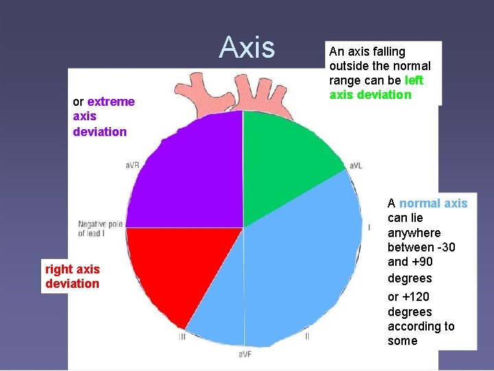 Axis or extreme axis deviation right axis deviation An axis falling outside the normal