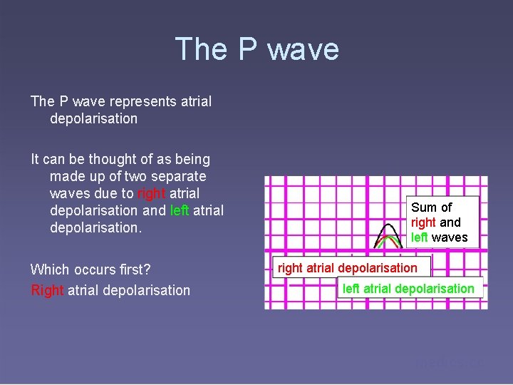 The P wave represents atrial depolarisation It can be thought of as being made