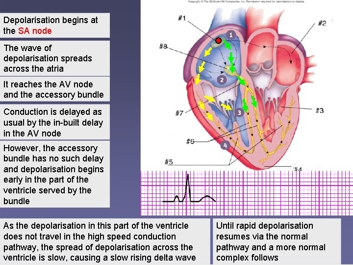 Depolarisation begins at the SA node The wave of depolarisation spreads across the atria