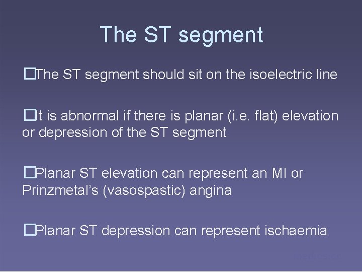 The ST segment �The ST segment should sit on the isoelectric line �It is