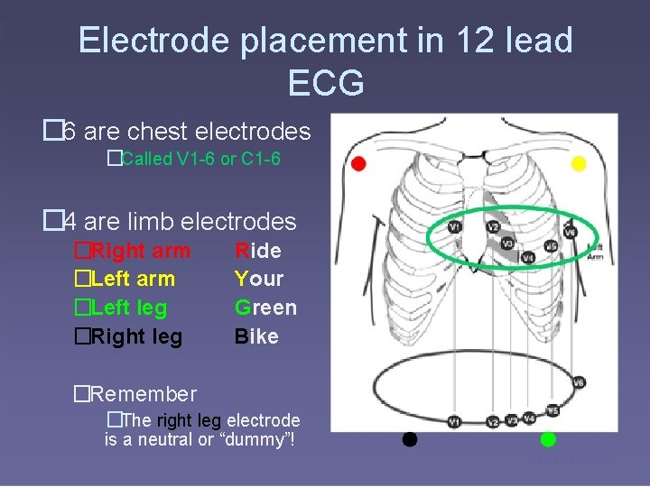 Electrode placement in 12 lead ECG � 6 are chest electrodes �Called V 1
