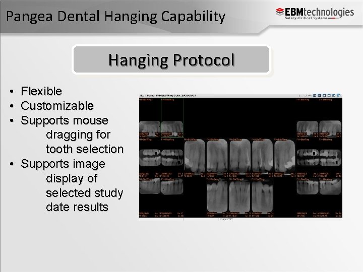Pangea Dental Hanging Capability Hanging Protocol • Flexible • Customizable • Supports mouse dragging