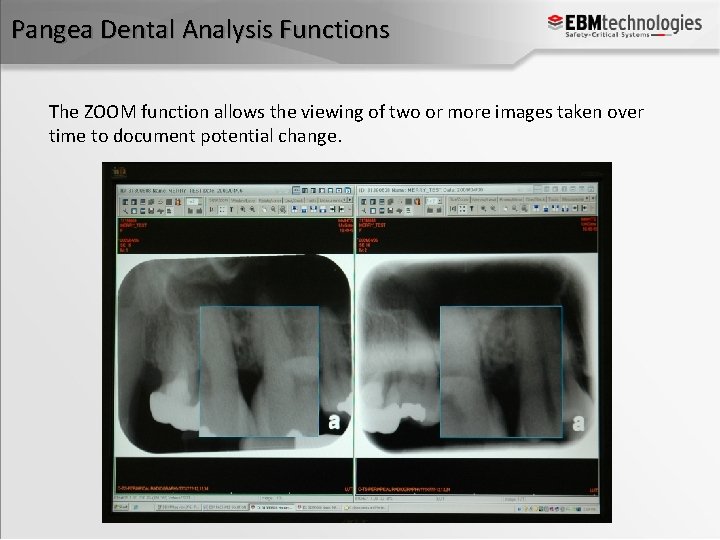 Pangea Dental Analysis Functions The ZOOM function allows the viewing of two or more