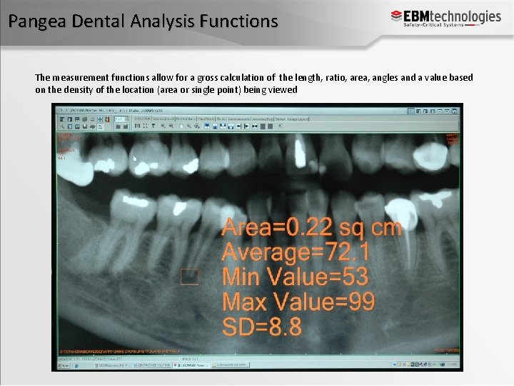 Pangea Dental Analysis Functions The measurement functions allow for a gross calculation of the