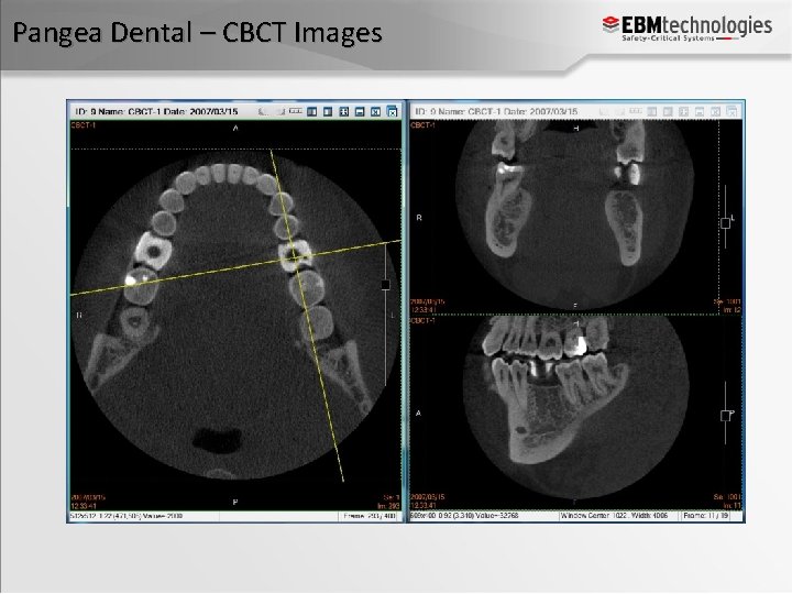 Pangea Dental – CBCT Images 