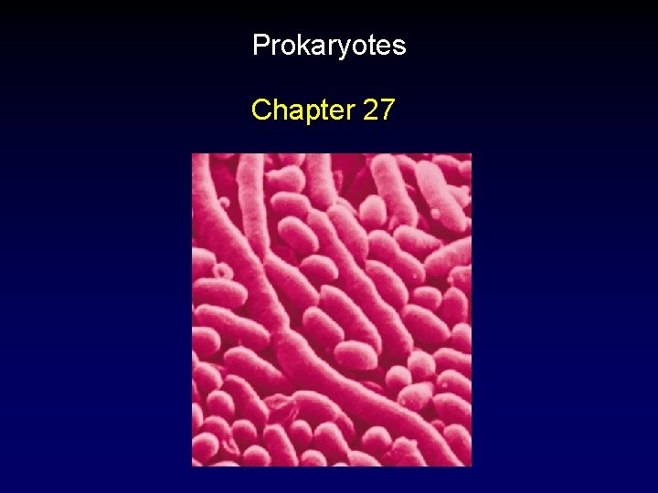 Prokaryotes Chapter 27 