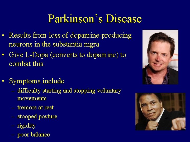 Parkinson’s Disease • Results from loss of dopamine-producing neurons in the substantia nigra •