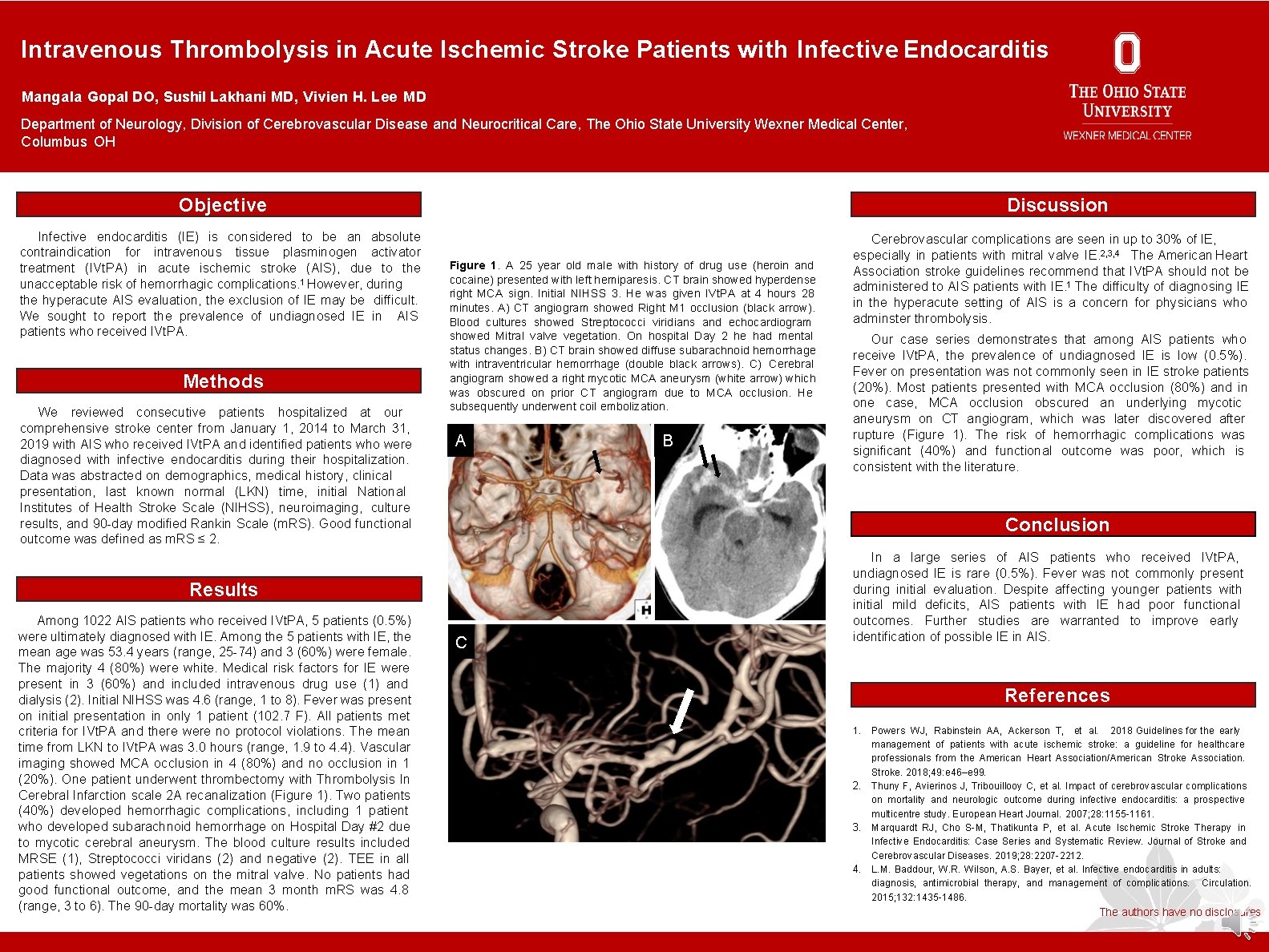 Intravenous Thrombolysis in Acute Ischemic Stroke Patients with