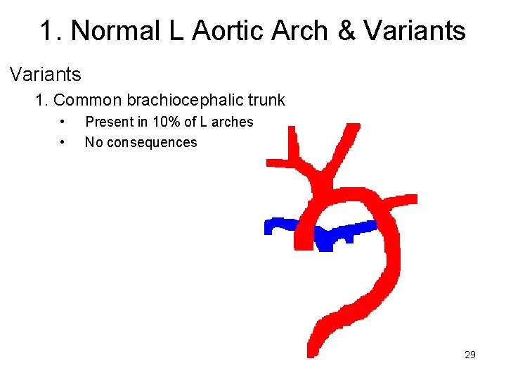 1. Normal L Aortic Arch & Variants 1. Common brachiocephalic trunk • • Present