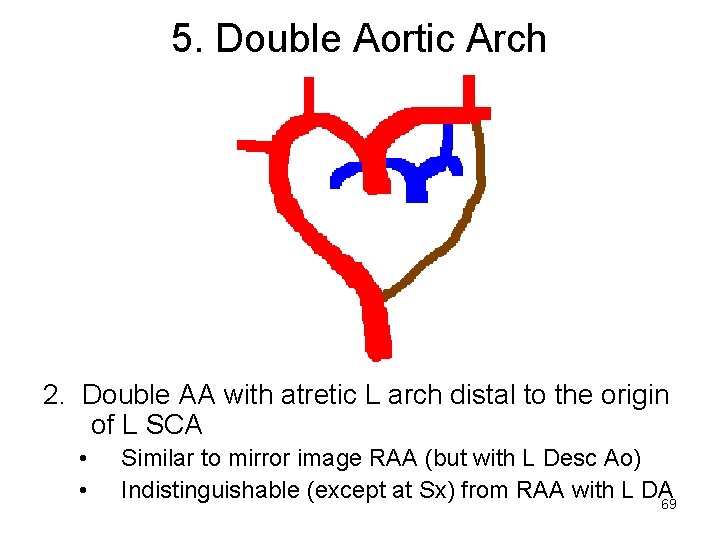 5. Double Aortic Arch 2. Double AA with atretic L arch distal to the