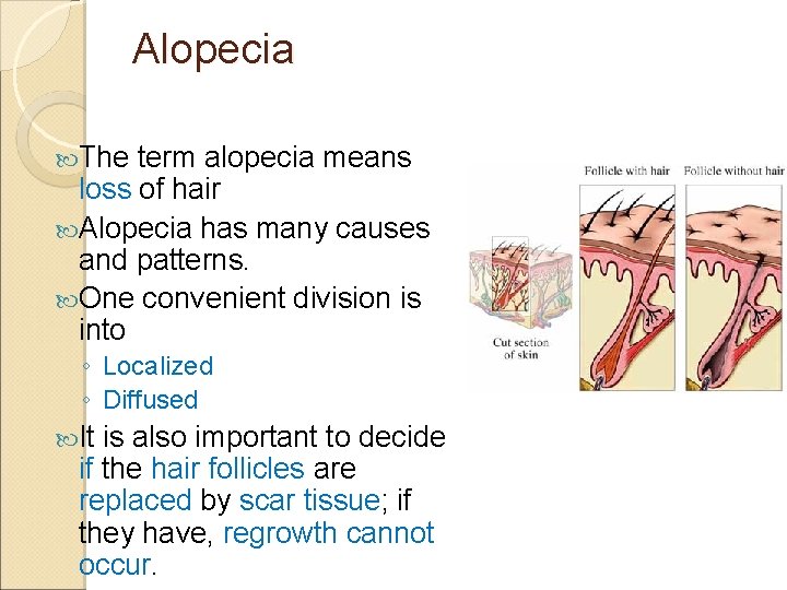 Alopecia The term alopecia means loss of hair Alopecia has many causes and patterns.