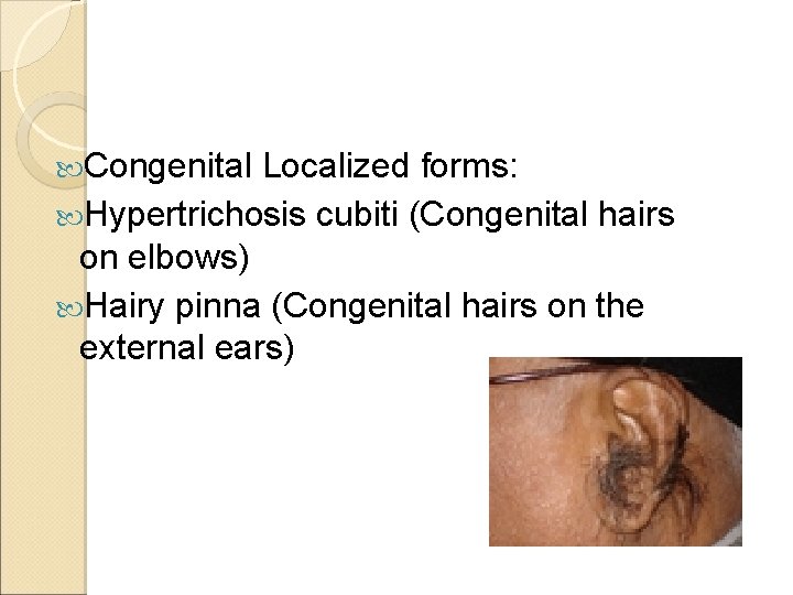  Congenital Localized forms: Hypertrichosis cubiti (Congenital hairs on elbows) Hairy pinna (Congenital hairs