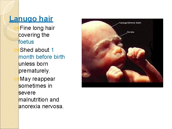 Lanugo hair Fine long hair covering the foetus Shed about 1 month before birth