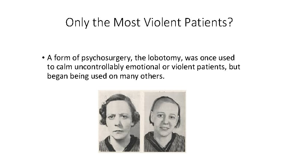 Only the Most Violent Patients? • A form of psychosurgery, the lobotomy, was once