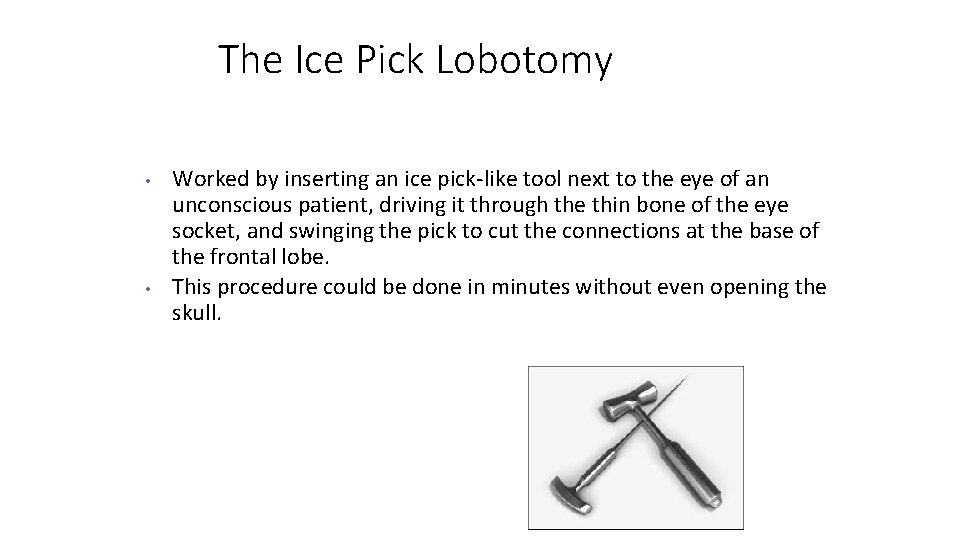 The Ice Pick Lobotomy • • Worked by inserting an ice pick-like tool next