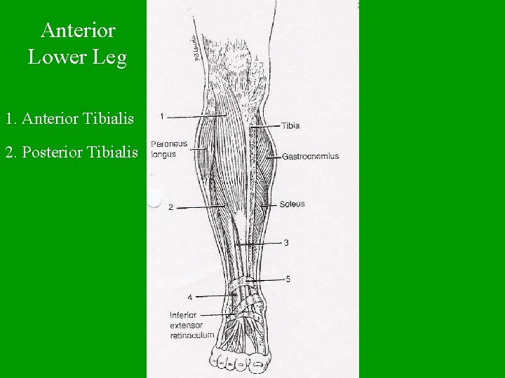 Anterior Lower Leg 1. Anterior Tibialis 2. Posterior Tibialis 