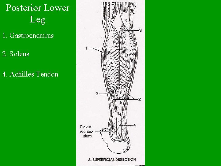 Posterior Lower Leg 1. Gastrocnemius 2. Soleus 4. Achilles Tendon 