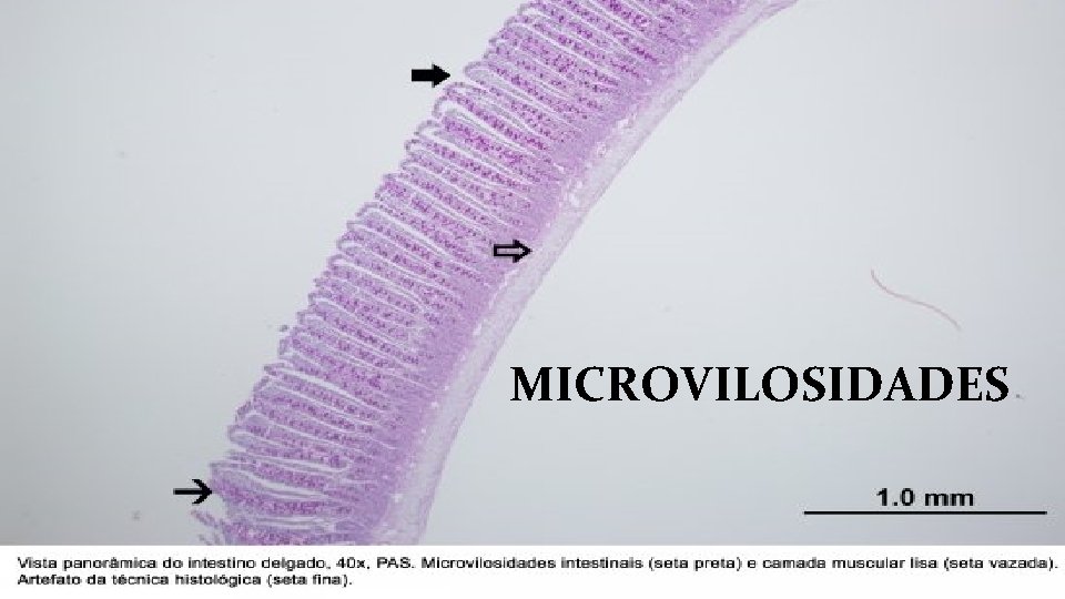 MICROVILOSIDADES 