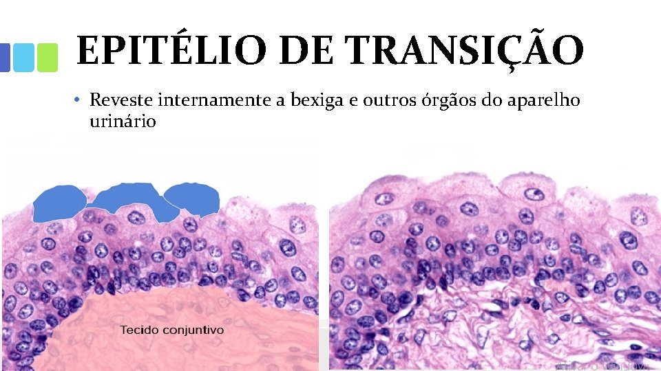 EPITÉLIO DE TRANSIÇÃO • Reveste internamente a bexiga e outros órgãos do aparelho urinário