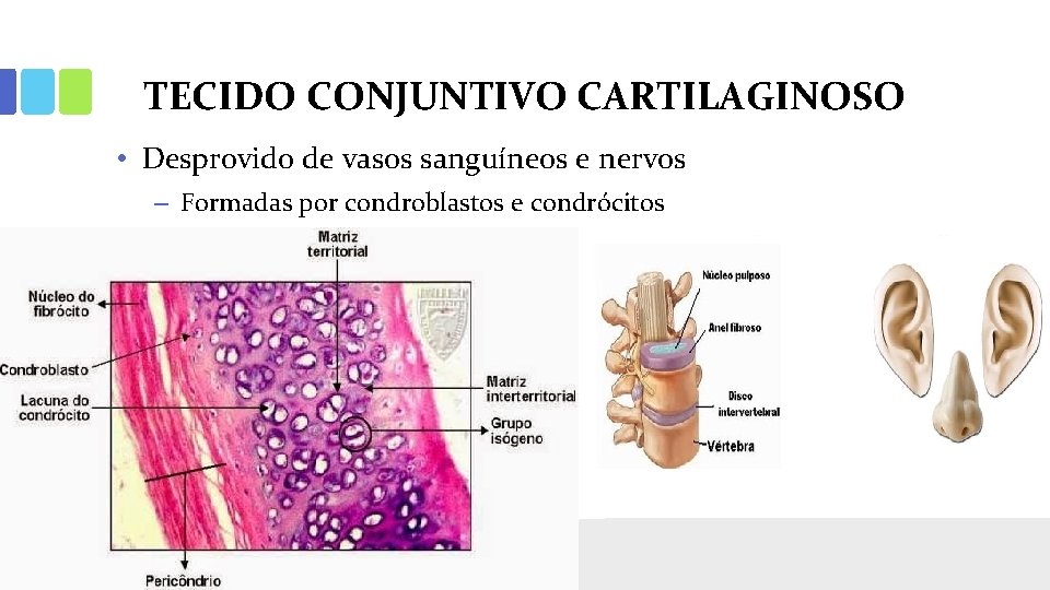 TECIDO CONJUNTIVO CARTILAGINOSO • Desprovido de vasos sanguíneos e nervos – Formadas por condroblastos