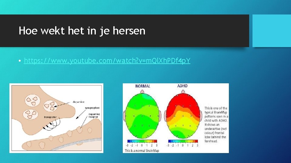 Hoe wekt het in je hersen • https: //www. youtube. com/watch? v=m. Ql. Xh.