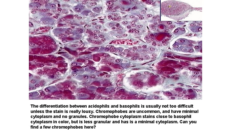 The differentiation between acidophils and basophils is usually not too difficult unless the stain