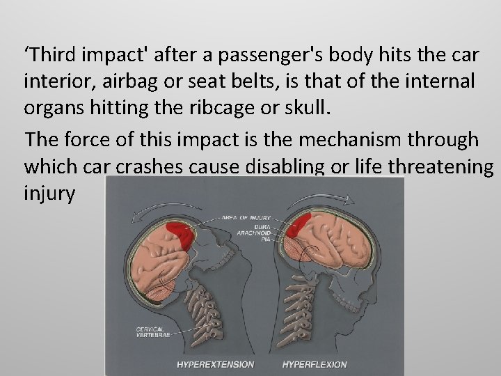 ‘Third impact' after a passenger's body hits the car interior, airbag or seat belts,