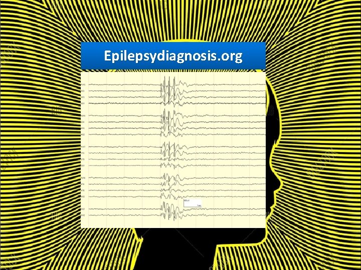 Epilepsydiagnosis. org 