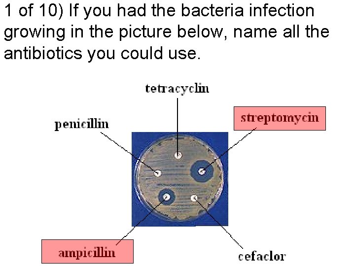 1 of 10) If you had the bacteria infection growing in the picture below,