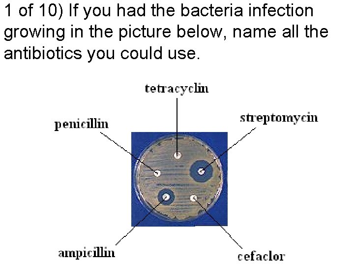 1 of 10) If you had the bacteria infection growing in the picture below,