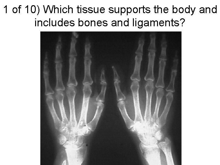 1 of 10) Which tissue supports the body and includes bones and ligaments? 