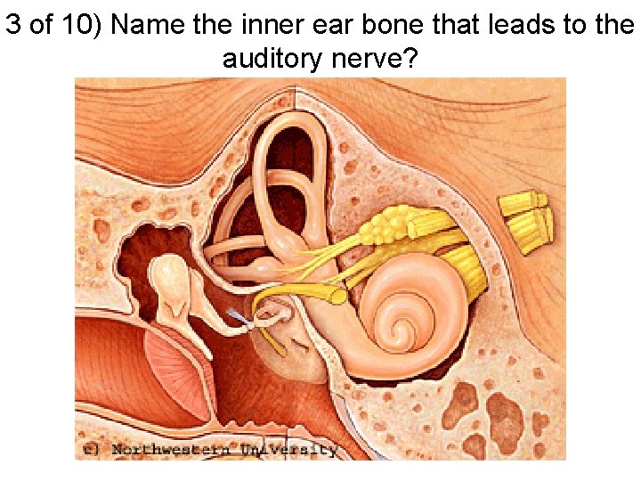 3 of 10) Name the inner ear bone that leads to the auditory nerve?