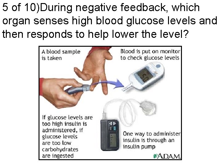 5 of 10)During negative feedback, which organ senses high blood glucose levels and then