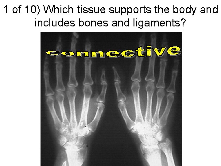 1 of 10) Which tissue supports the body and includes bones and ligaments? 