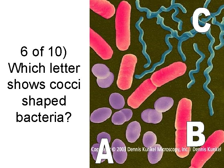 6 of 10) Which letter shows cocci shaped bacteria? 