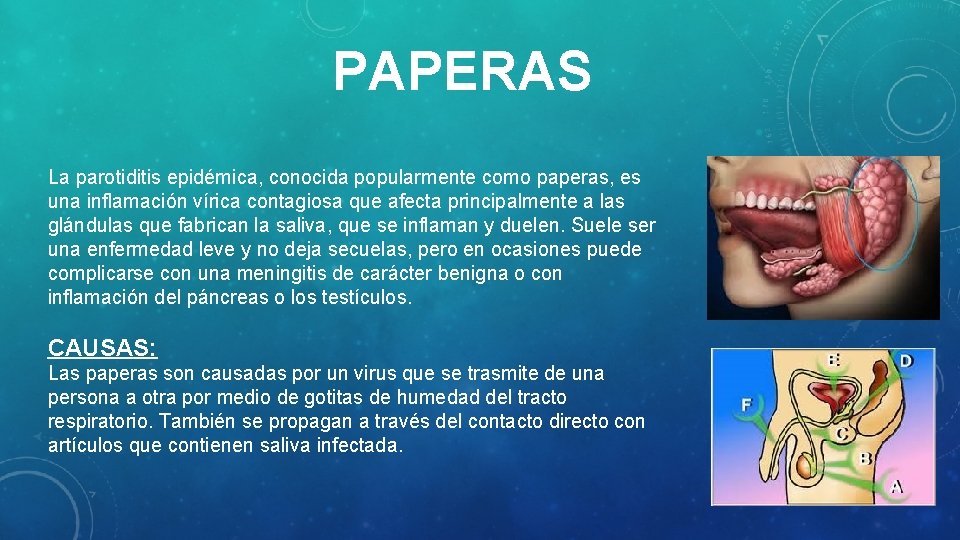 PAPERAS La parotiditis epidémica, conocida popularmente como paperas, es una inflamación vírica contagiosa que