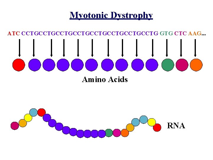 Myotonic Dystrophy ATC CCTGCCTGCCTGCCTG GTG CTC AAG. . . Amino Acids RNA 