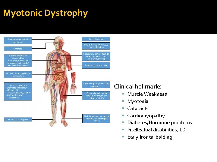 Myotonic Dystrophy Clinical hallmarks Muscle Weakness Myotonia Cataracts Cardiomyopathy Diabetes/Hormone problems Intellectual disabilities, LD