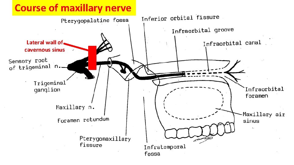 Course of maxillary nerve Lateral wall of cavernous sinus 