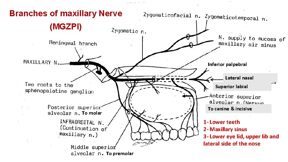 Branches of maxillary Nerve (MGZPI) Inferior palpebral Lateral nasal Superior labial To canine &