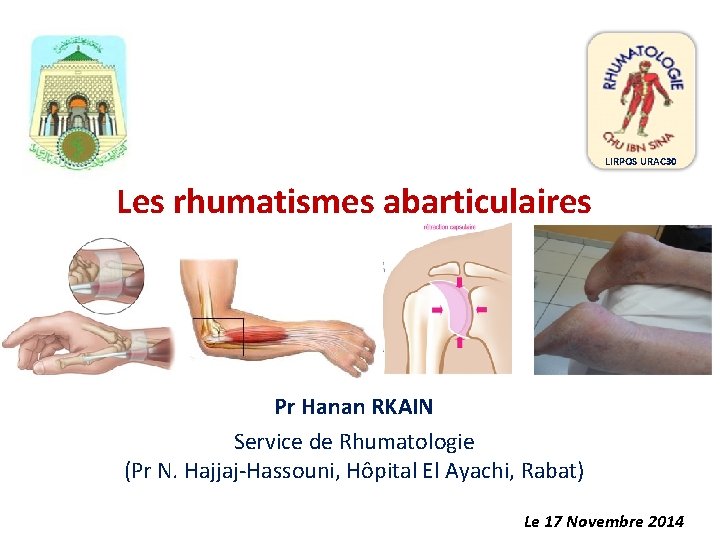 LIRPOS URAC 30 Les rhumatismes abarticulaires Pr Hanan RKAIN Service de Rhumatologie (Pr N.