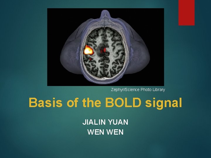 Zephyr/Science Photo Library Basis of the BOLD signal JIALIN YUAN WEN 
