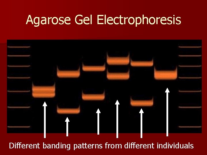 Agarose Gel Electrophoresis Different banding patterns from different individuals 