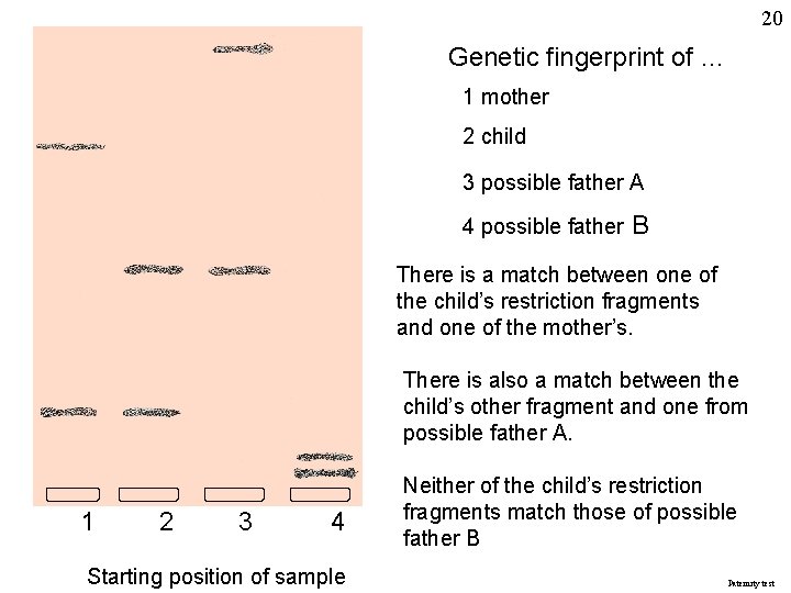 20 Genetic fingerprint of … 1 mother 2 child 3 possible father A 4