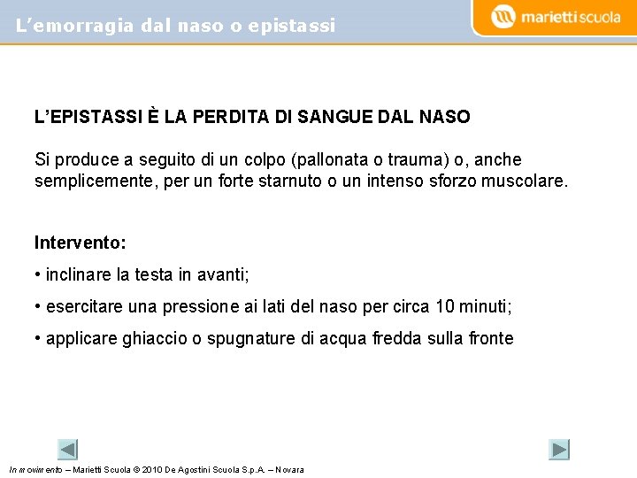 L’emorragia dal naso o epistassi L’EPISTASSI È LA PERDITA DI SANGUE DAL NASO Si