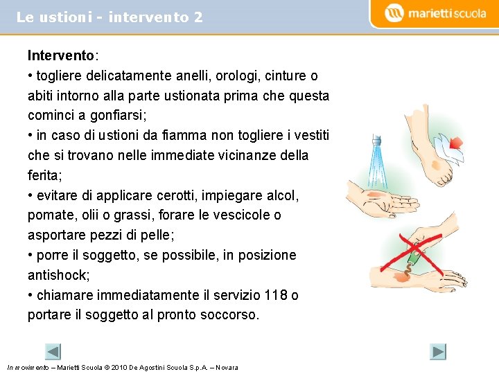 Le ustioni - intervento 2 Intervento: • togliere delicatamente anelli, orologi, cinture o abiti